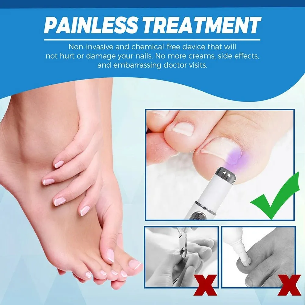 Antifungal Laser Device - Nail Fungus Treatment Pen Anti-fungal Repair Pen Blue Light Laser Pen