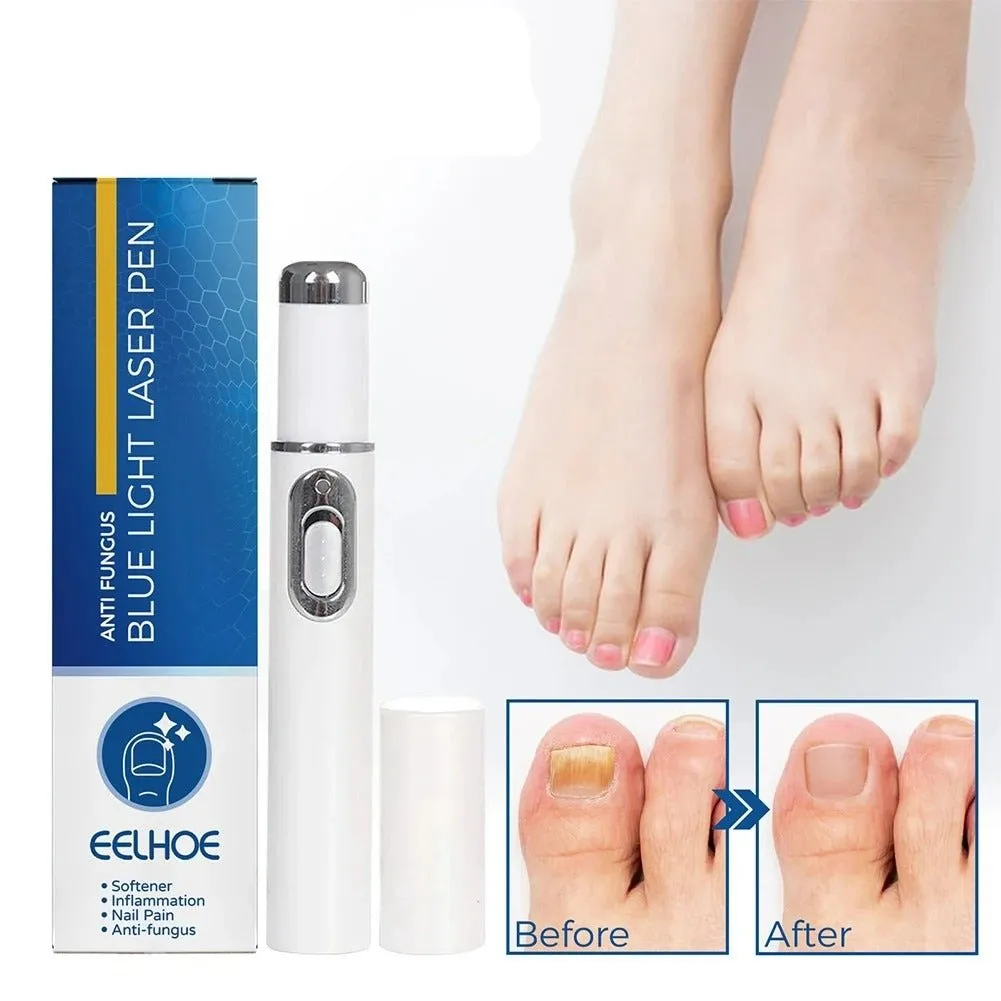 Antifungal Laser Device - Nail Fungus Treatment Pen Anti-fungal Repair Pen Blue Light Laser Pen